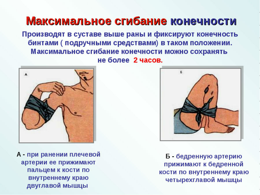 Острое Варикозное Кровотечение