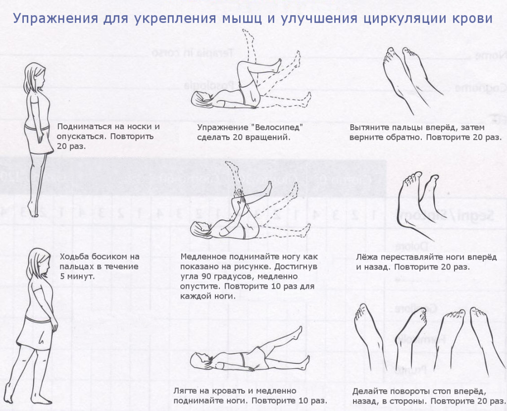 Варикоз Упражнения Для Лечения