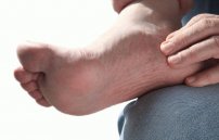 Вены на ступнях ног: симптомы и лечение