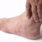 Отеки ног: причины и лечение у пожилых народными средствами