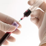 Анализ крови на тромбозы вен thumbnail