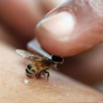 Варикозное расширение вен лечение укусом пчелы thumbnail