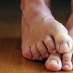 Причины и лечение онемения ног при варикозе