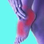 Причины и лечение онемения ног при варикозе