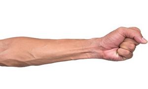 Методы лечения флебита вен на руках