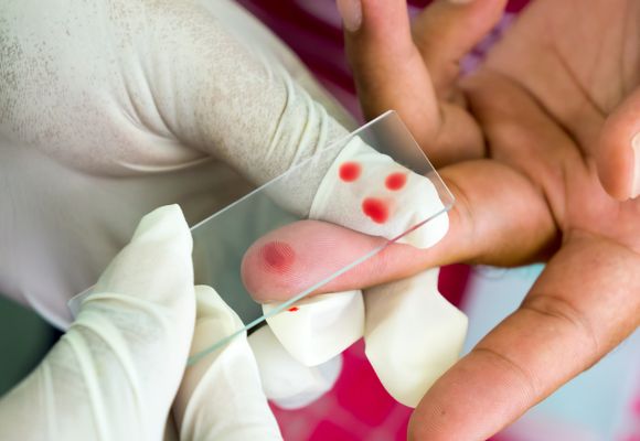Причины и методы лечения тромбоза нижней полой вены