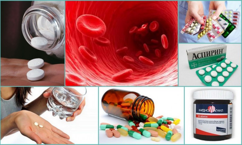 Разжижение крови таблетками и лекарствами без аспирина
